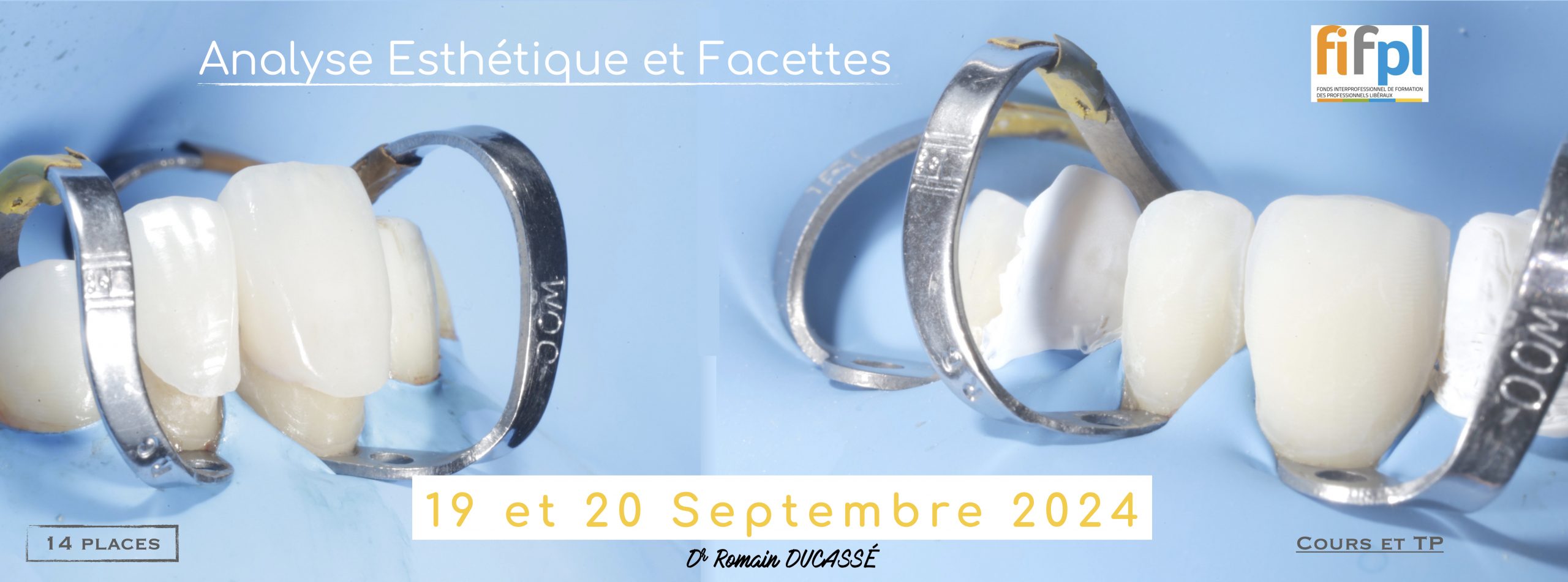 facettes toulouse ADESO