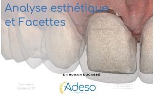 Formation esthétique et facettes