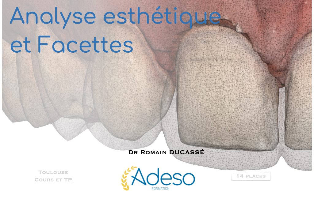 Formation esthétique et facettes